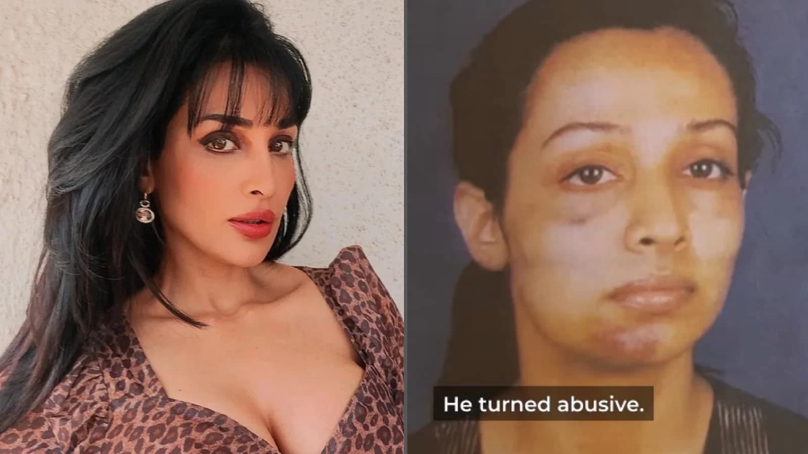 Flora Saini ने बयां की अपने अब्यूसिव रिलेशनशिप की कहानी, सुनकर दिल दहला देगी