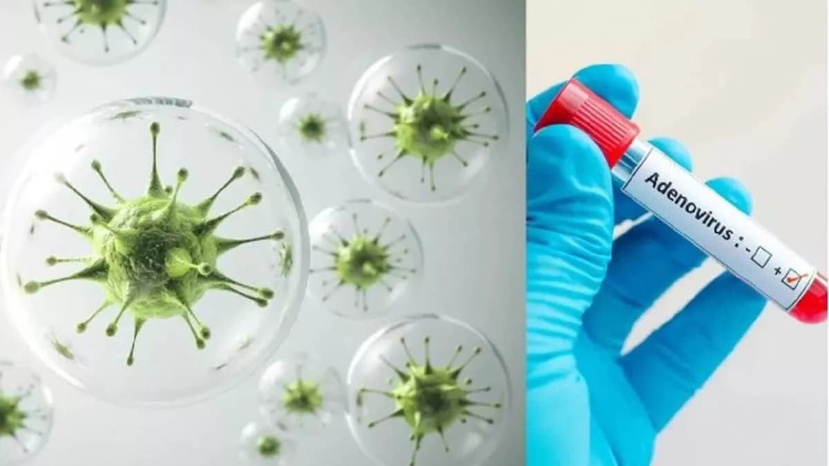 Adeno virus: देशभर में एडेनो वायरस का कहर, कोरोना के जैसा है खतरनाक। ये symtoms हों तो रहें सतर्क!
