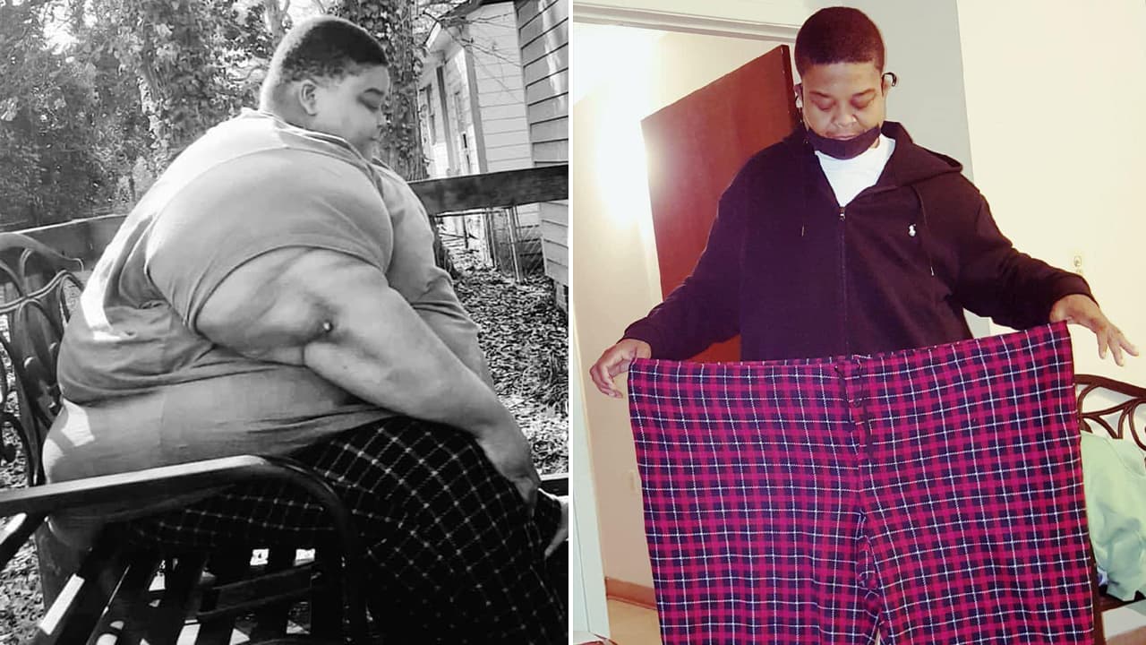 Weight Loss: डॉक्टर ने कहा मैं 3 साल में मर जाऊंगा, 165 KG वजन कम किया। आज जीते हैं मस्त लाइफ। जानें कैसे दी मोटापे को मात!