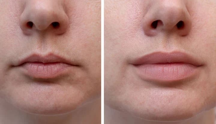 Cucumber Lip Balm: खीरे की लिप बाम से होंठों को रखें गुलाबी और मुलायम, जाने बनाने की विधि...!!