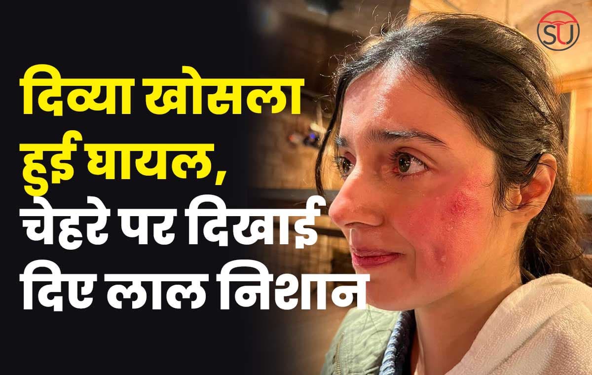 Divya Khosla: दिव्या खोसला एक्शन सीन के दौरान हुई घायल, चेहरे पर दिखे लाल निशान,देखें तस्वीरें