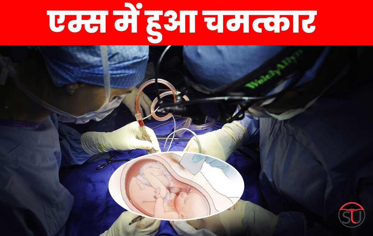 AIIMS के डॉक्टरों किया हैरान  : गर्भ के अंदर पल रहे बच्चे की कर दी हार्ट सर्जरी,मात्र डेढ मिनट में