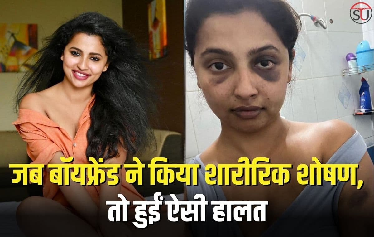 मलयालम अभिनेत्री Anicka Vikhraman के बाॅयफ्रेंड ने जब किया शारीरिक शोषण तो हुईं ऐसी हालत, यहाँ देखें तस्वीरें 