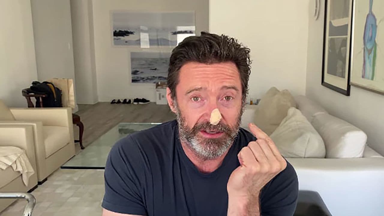 एक्स-मेन फिल्मों में वूल्वरिन नाम से चर्चित अभिनेता Hugh Jackman ने दी सनस्क्रीन इस्तेमाल करने की सलाह, साझा किया विडियो