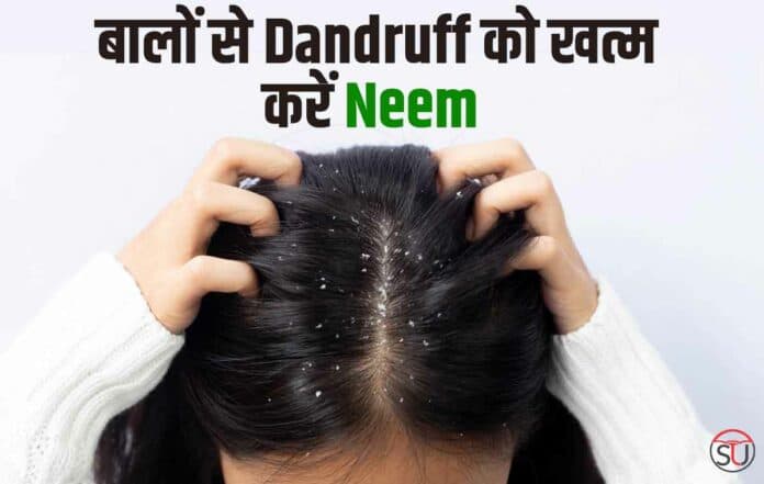 Dandruff से पाना चाहते हैं छुटकारा, तो लें नीम का सहारा, जानें नीम से जुड़े कई उपाय!!