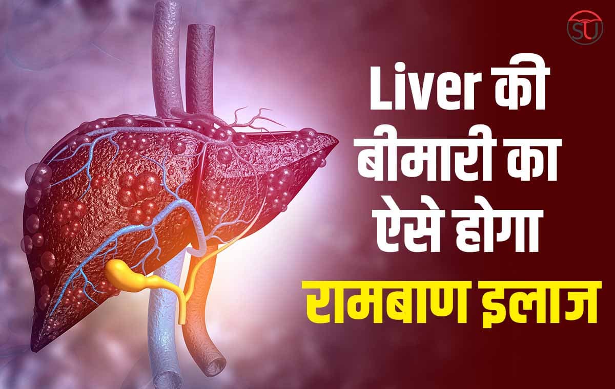 अपने Liver को इन रामबाण औषधियों से रखें तंदुरुस्त, नहीं झेलनी पड़ेंगी घातक बीमारियां !!