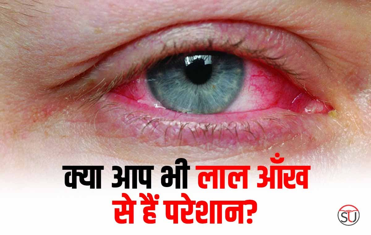 क्या आपकी आँख भी हमेशा बनी रहती है लाल? तो सावधान हो जाएं क्योंकि ये हो सकता है बीमीरियों का अंदेशा !!