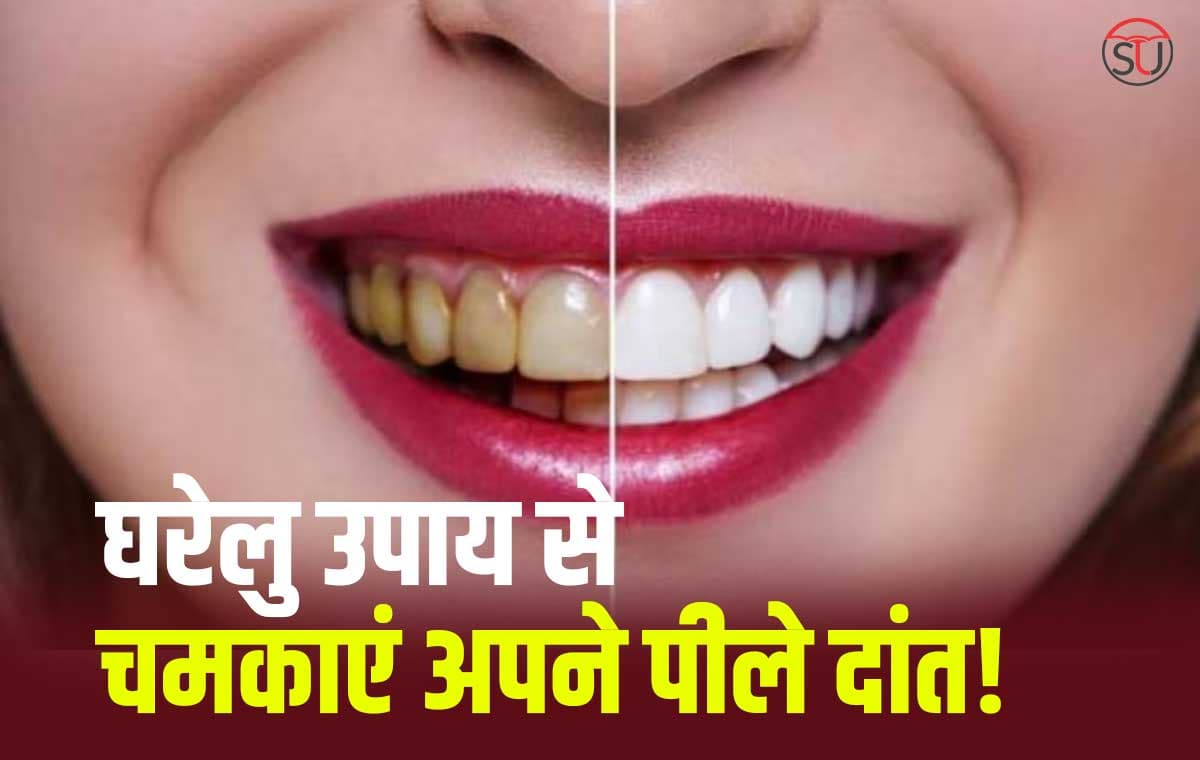 Yellow Teeth: पीले दांत को करें झट से साफ, इन उपाचारों से चमकाएं दांत की खिल उठे आपकी हँसी