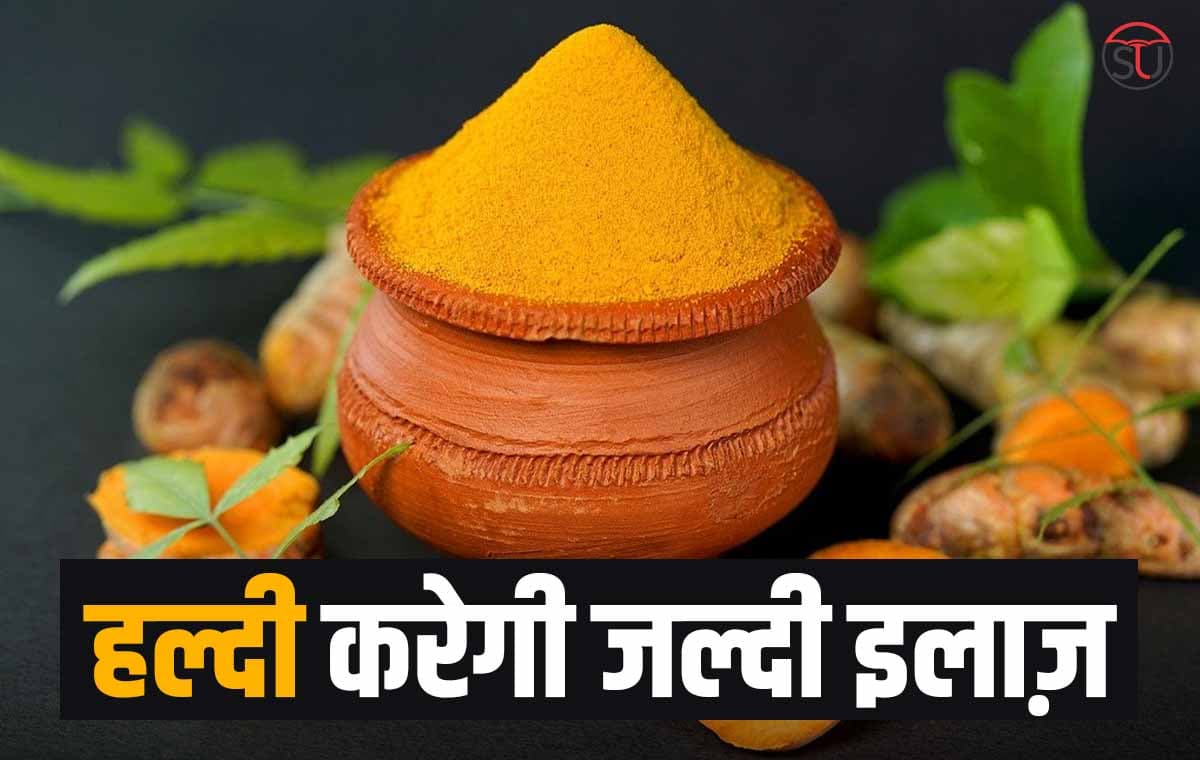Turmeric: कई गुणों से भरपूर हल्दी है बहुत लाभकारी, मरहम से लेकर कई रोगों का करती है इलाज, जानें यहां!