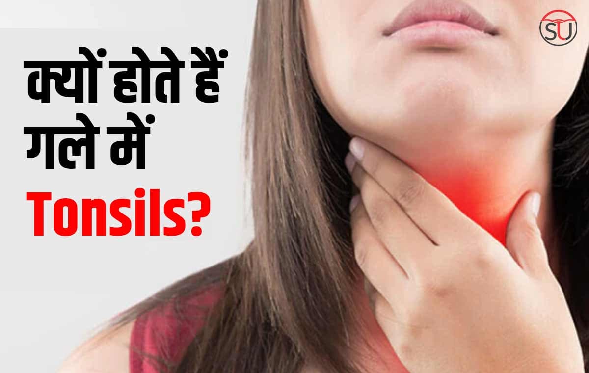 Tonsils: गले में हो रहा 3 दिन से ज्यादा दर्द, तो तुरंत डॉक्टर से करें सम्पर्क, हो सकते हैं Tonsils!!