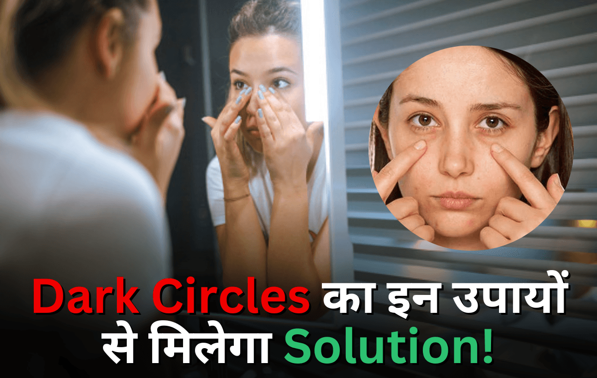 Dark Circles से मिलेगा पूरी तरह से निजात, ख्याल रखें इन बेहतरीन उपायों के साथ !!