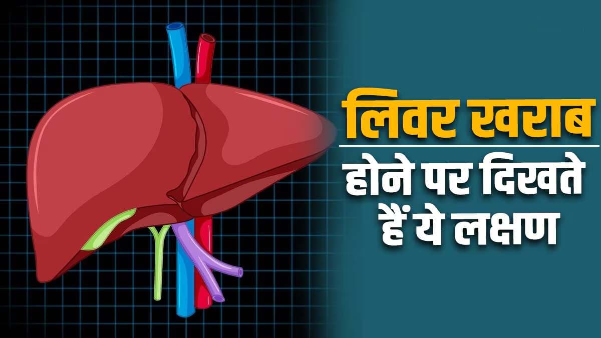 World Liver Day 2024: हर 5 में से एक व्‍यक्ति को है लिवर की समस्या! भूलकर भी न करें अनदेखा