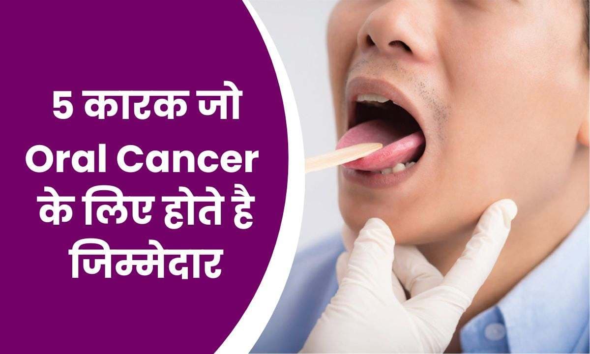5 कारक जो Oral Cancer पैदा करने के लिए होते है जिम्मेदार