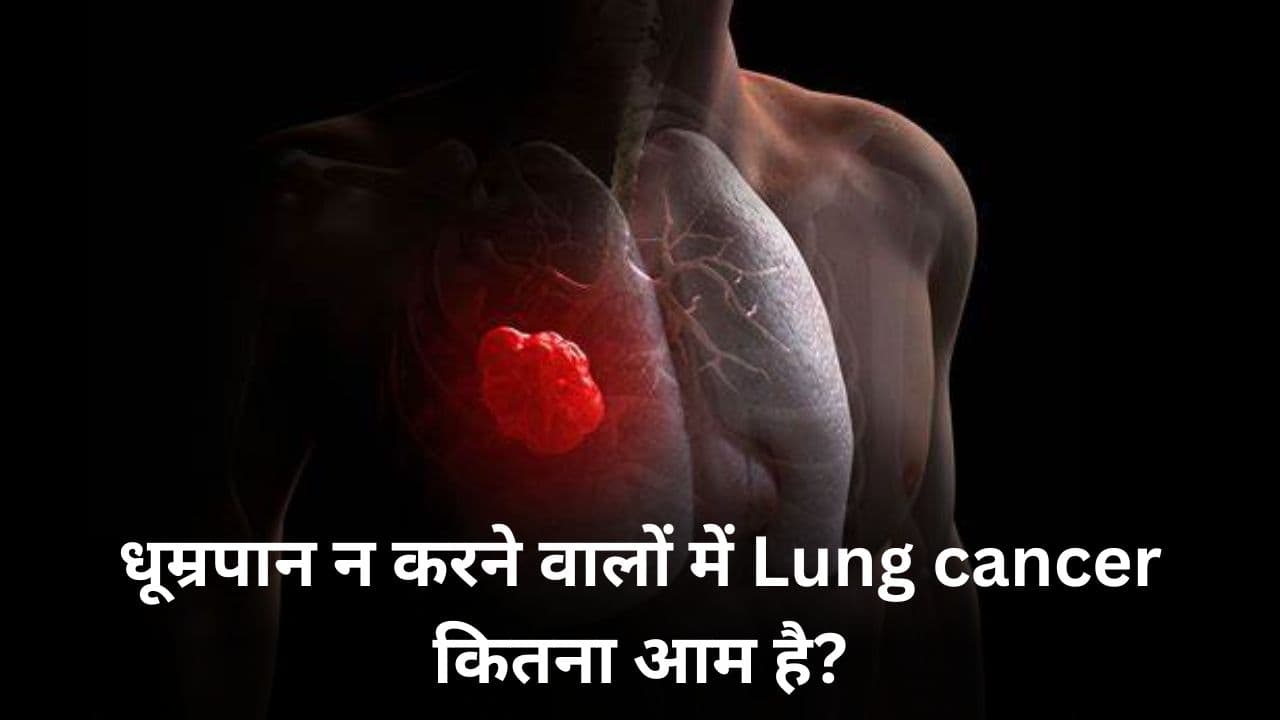 Lung Cancer is Nonsmokers: धूम्रपान न करने वालों में lung cancer कितना आम है?