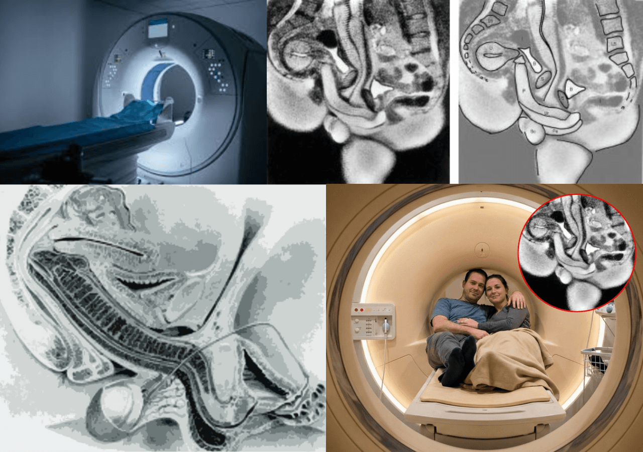 MRI Sex Experiment: जब MRI मशीन के अंदर कपल ने किया सेक्स— वैज्ञानिकों को मिला ऐसा सच जिसने बदल दी मेडिकल किताबें