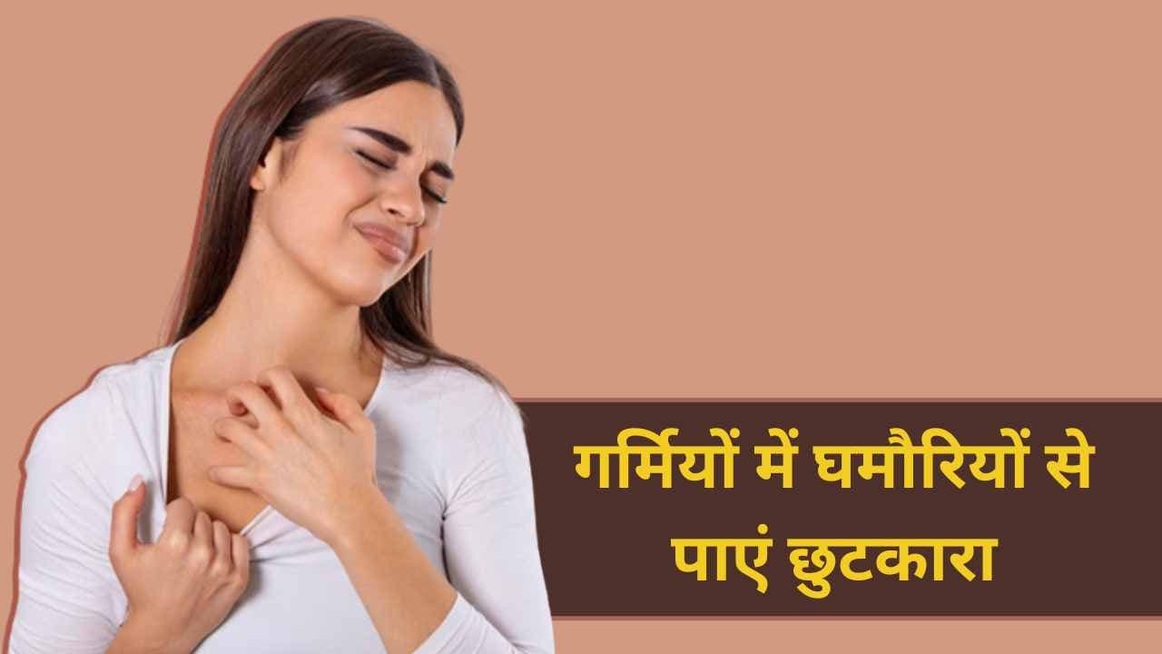 गर्मियों में घमौरियों से पाएं छुटकारा: 7 आसान घरेलू उपाय और बचाव के तरीके