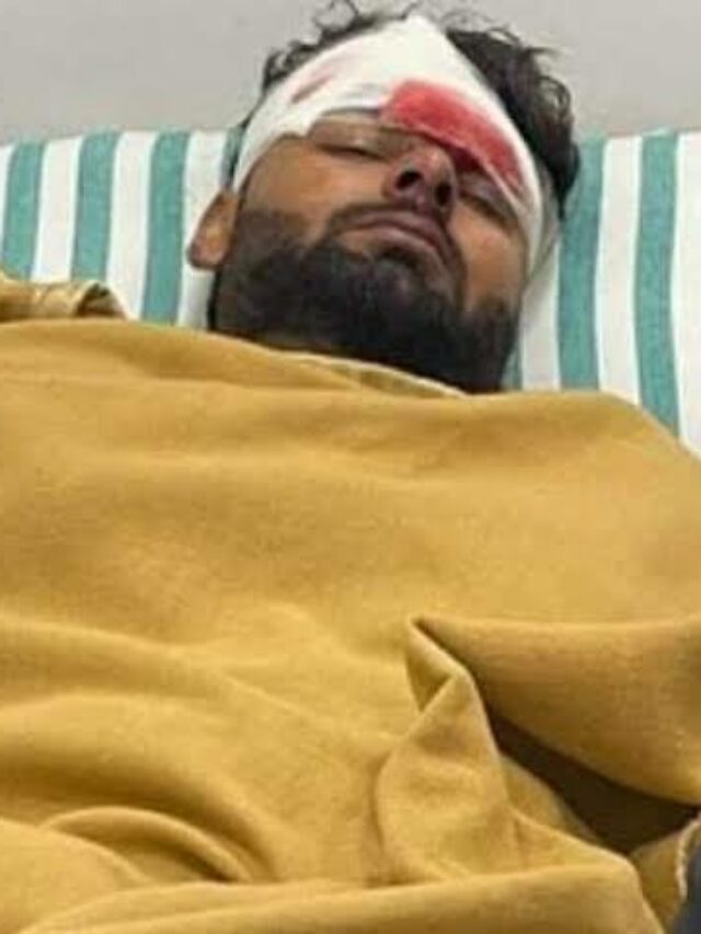 Rishabh Pant कार एक्सीडेंट में बुरी तरह घायल:जलती कार की खिड़की तोड़ बाहर निकले