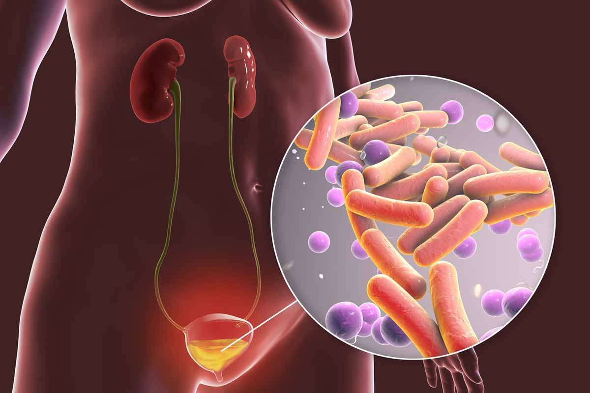 Urine Infection