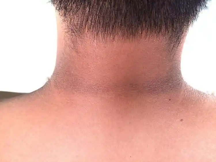 k Neck
