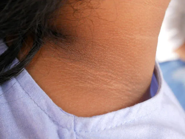 Neck