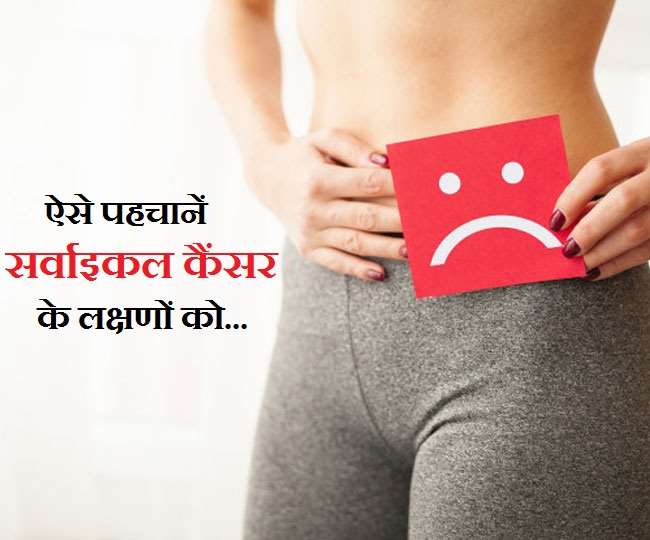 Cervical Cancer