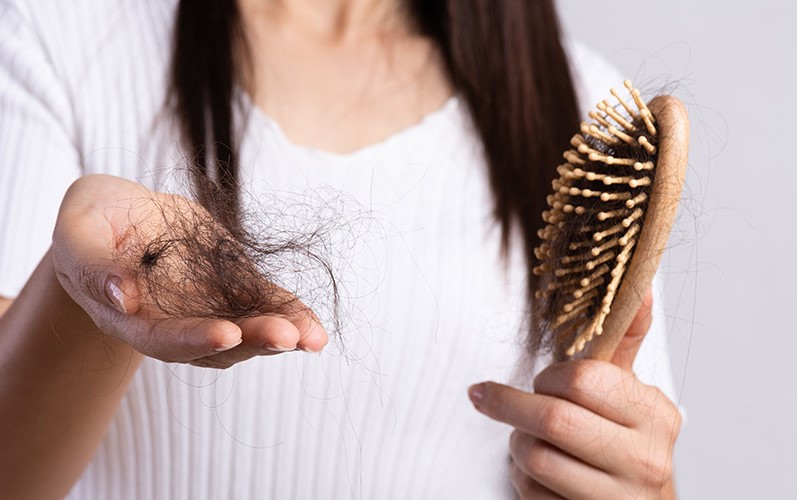 Hair Loss