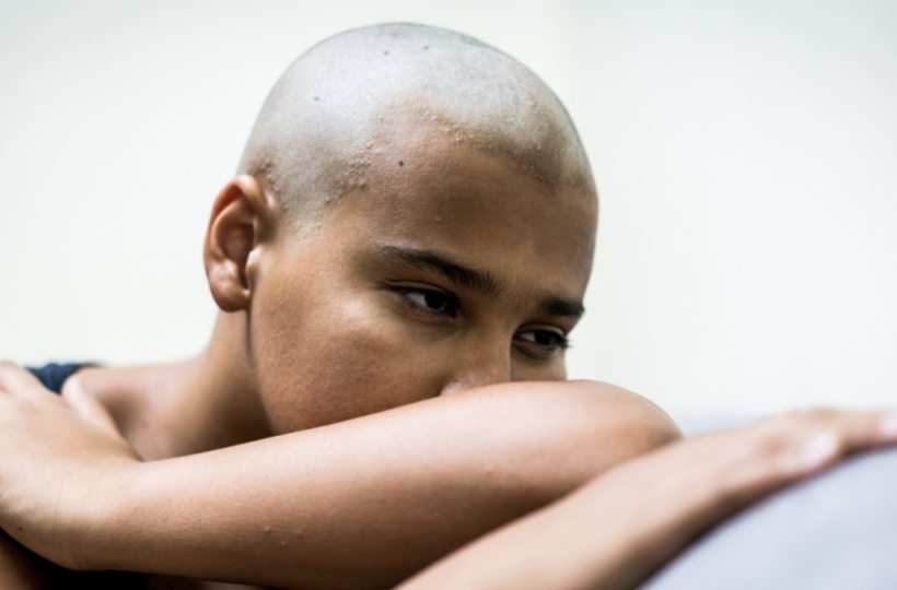 Hair Loss