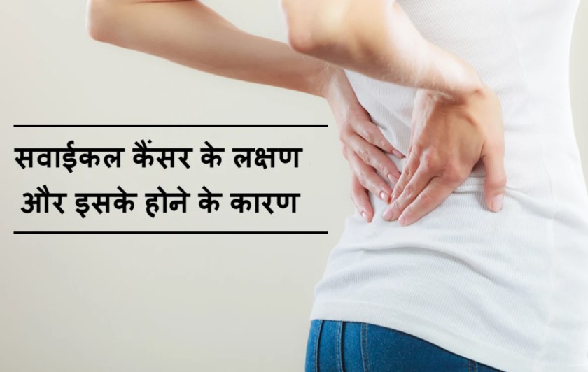 Cervical Cancer