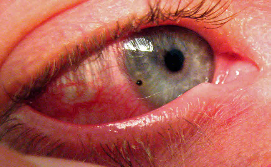 Eyes
