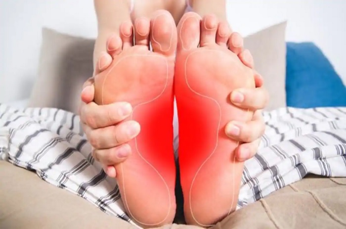 Uric Acid