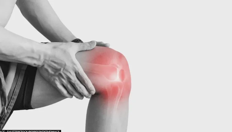 Arthritis