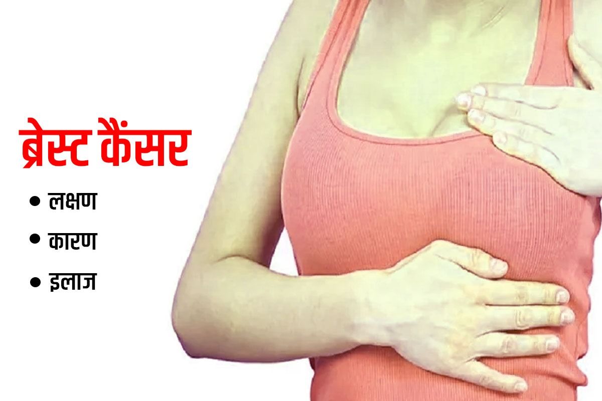 Breast Cancer