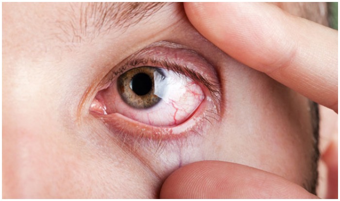 Red Eye