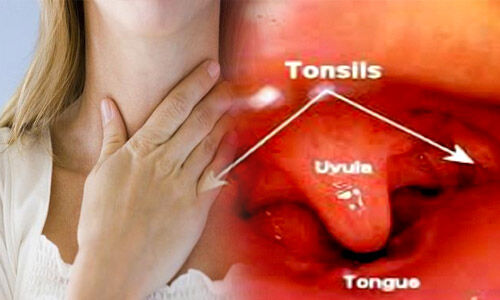 Tonsils