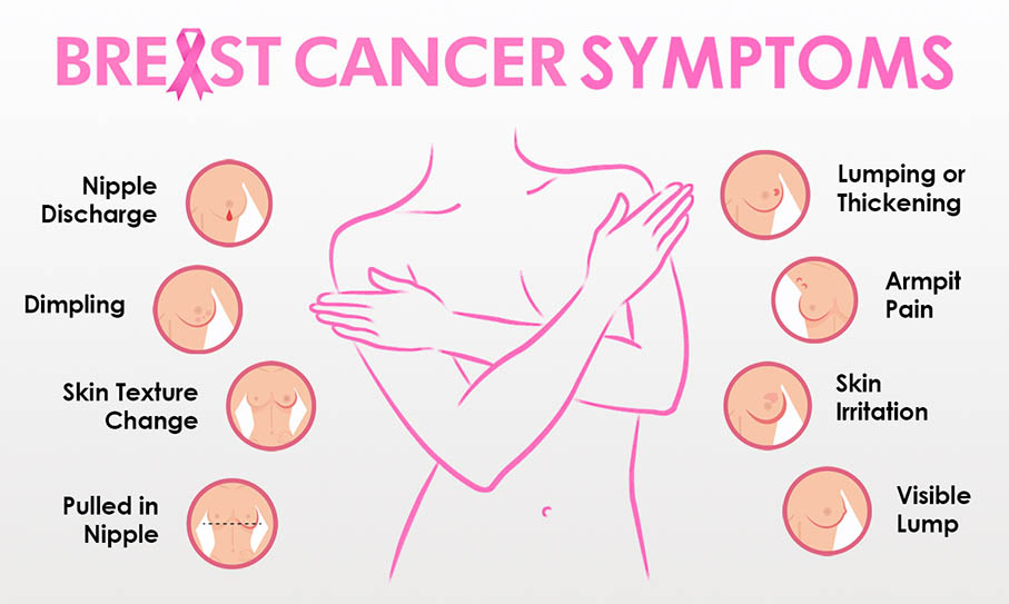Breast Cancer