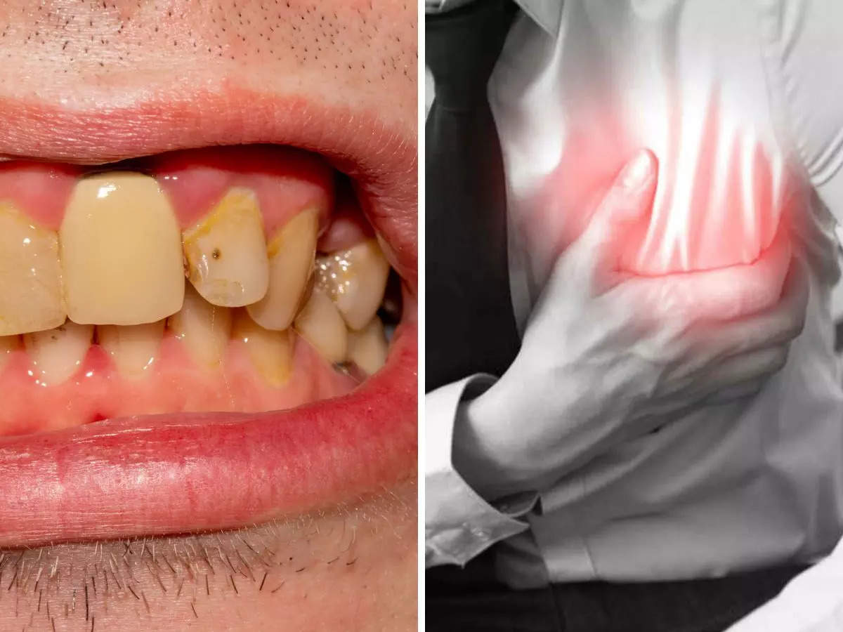 Oral Cancer