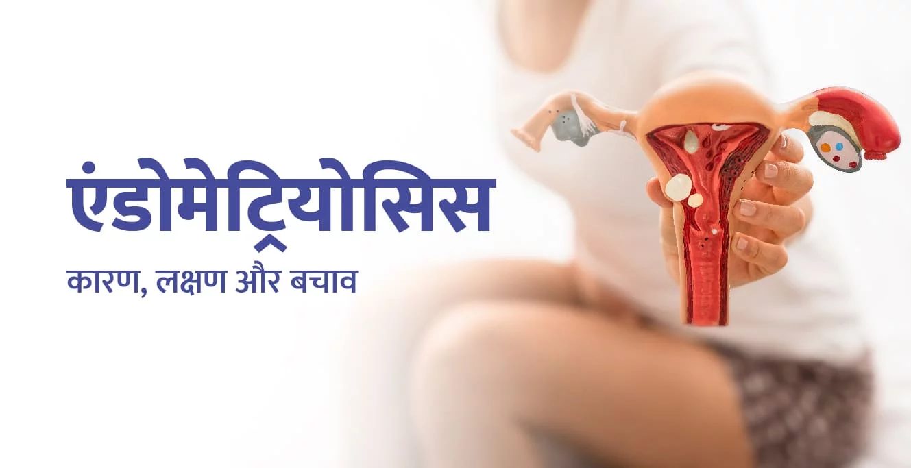 एंडोमेट्रियोसिस Endometriosis