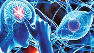 Migraine Headaches
