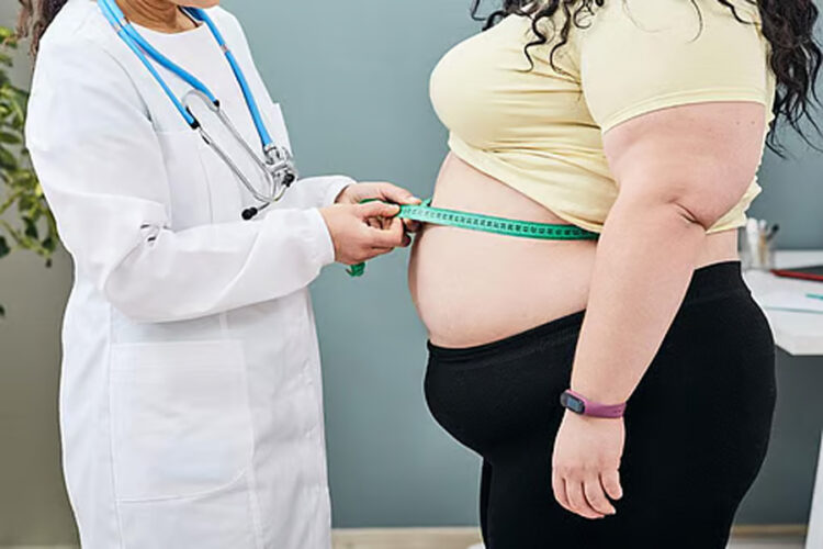 Obesity Major Problem