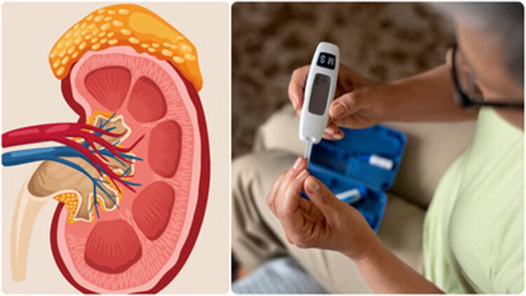 Diabetes Effect