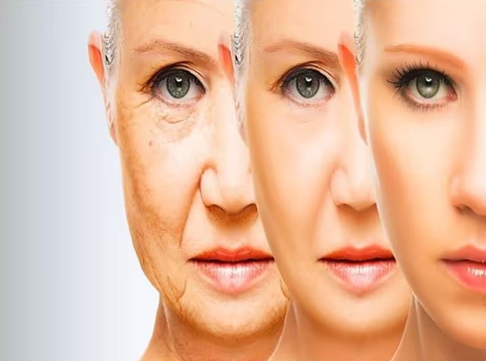 Wrinkles on face