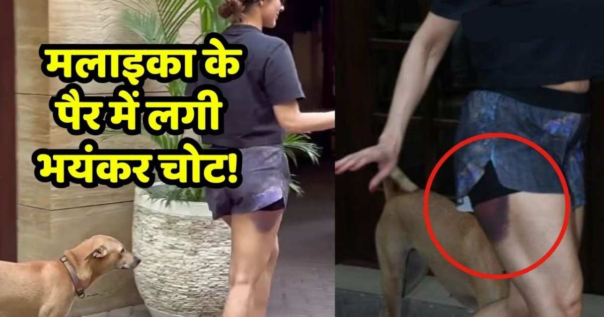 Malaika Arora Injury