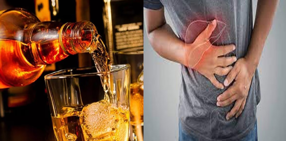 Alcohol is a threat to the liver