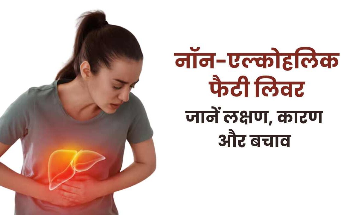 फैटी लिवर