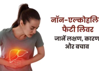 फैटी लिवर