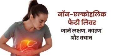 फैटी लिवर