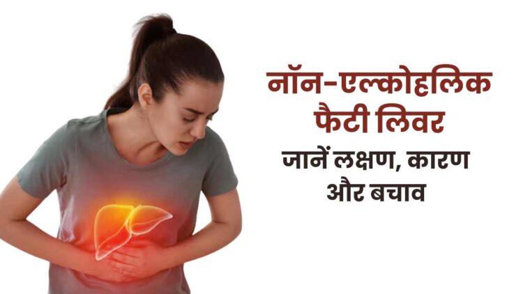 फैटी लिवर