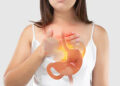 Heartburn Relief