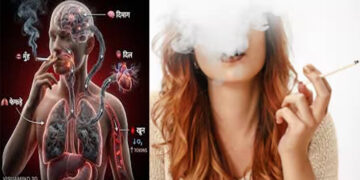 Smokers Brains Shrinking 1 Smokers Brains Shrinking