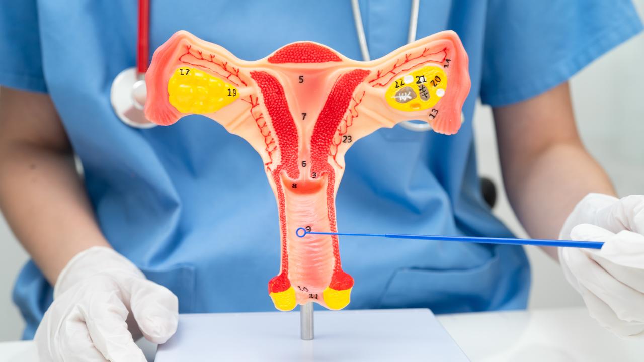 Vaginal Discharge 1 वजाइनल डिस्चार्ज